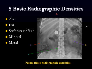 5 Basic Radiographic Densities
 Air
 Fat
 Soft tissue/fluid
 Mineral
 Metal
1.
2.
3.
4.
5.
Name these radiographic densities.
 