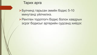 Тарих арга
Булчинд тарьсан эмийн бодис 5-10
минутанд үйлчилнэ.
Рентген тодотгогч бодис болон хавдрын
эсрэг бодисыг артерийн судсанд хийдэг.
 