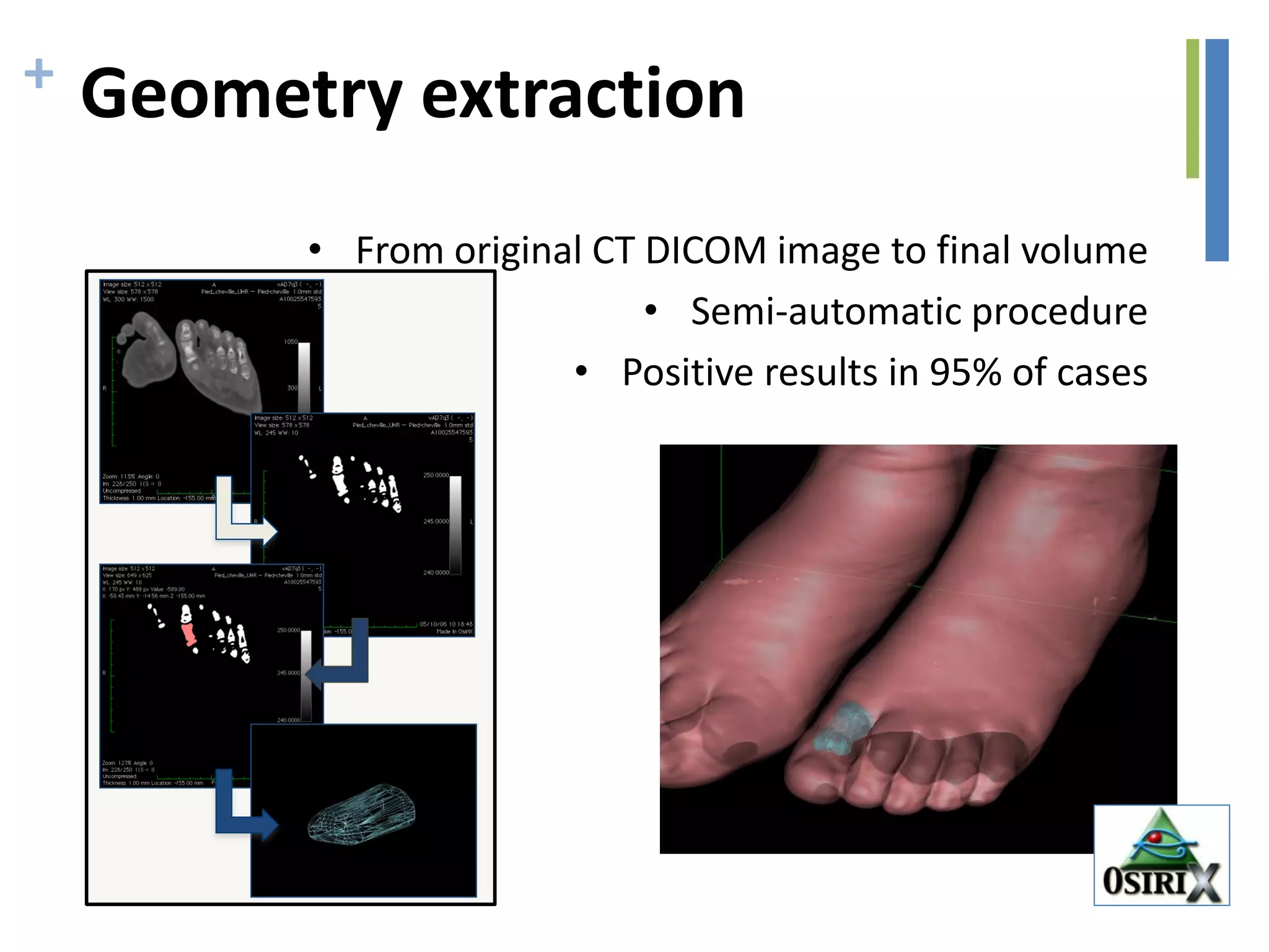 + Geometry extraction
• From original CT DICOM image to final volume
• Semi-automatic procedure
• Positive results in 95% of cases
 