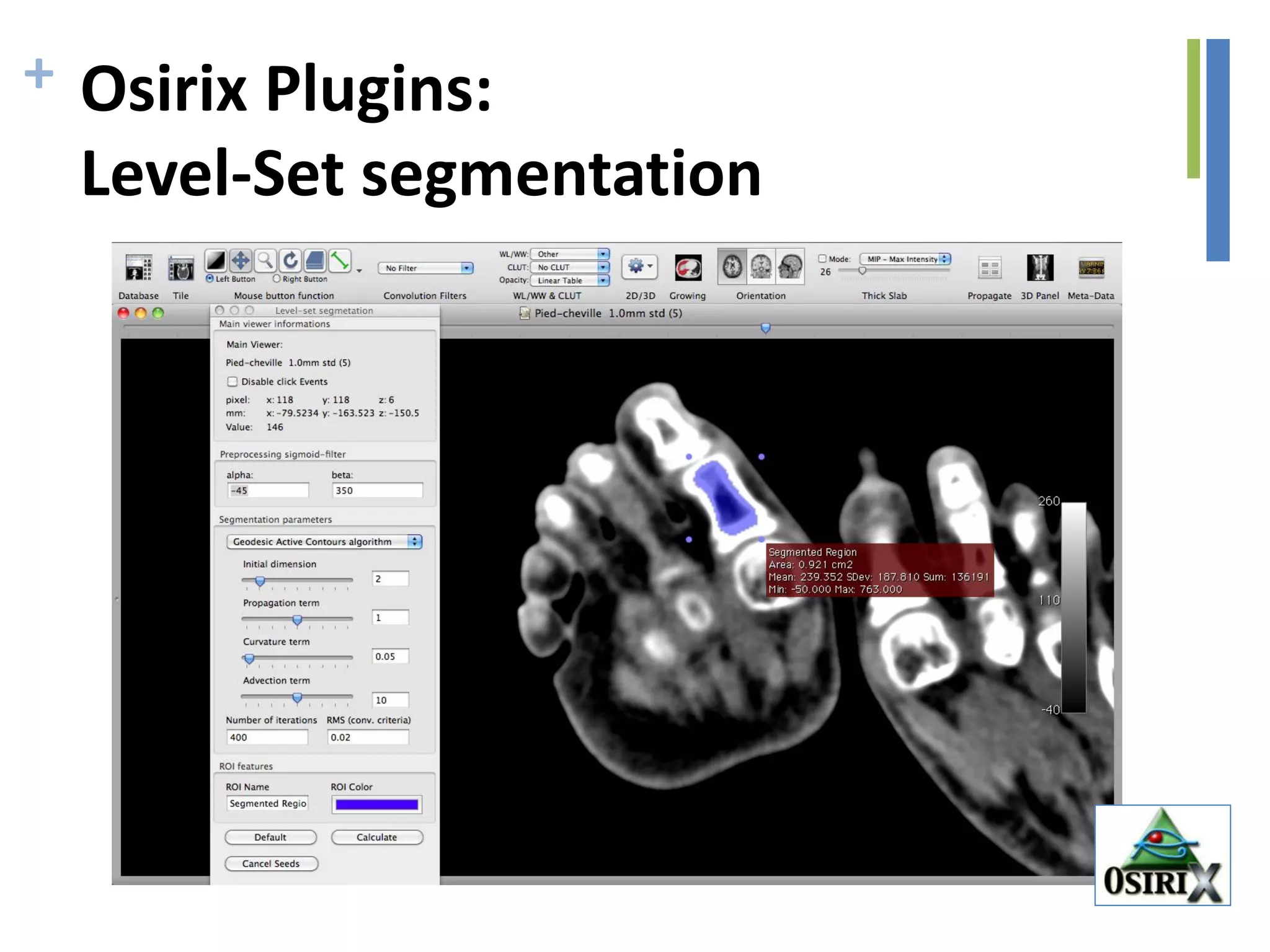 + Osirix Plugins:
Level-Set segmentation
 