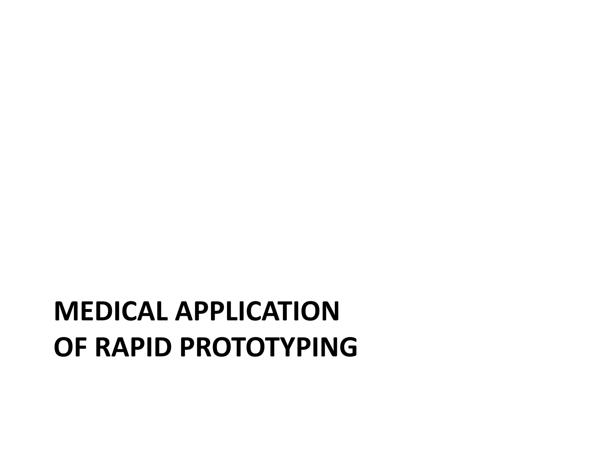 MEDICAL APPLICATION
OF RAPID PROTOTYPING
 