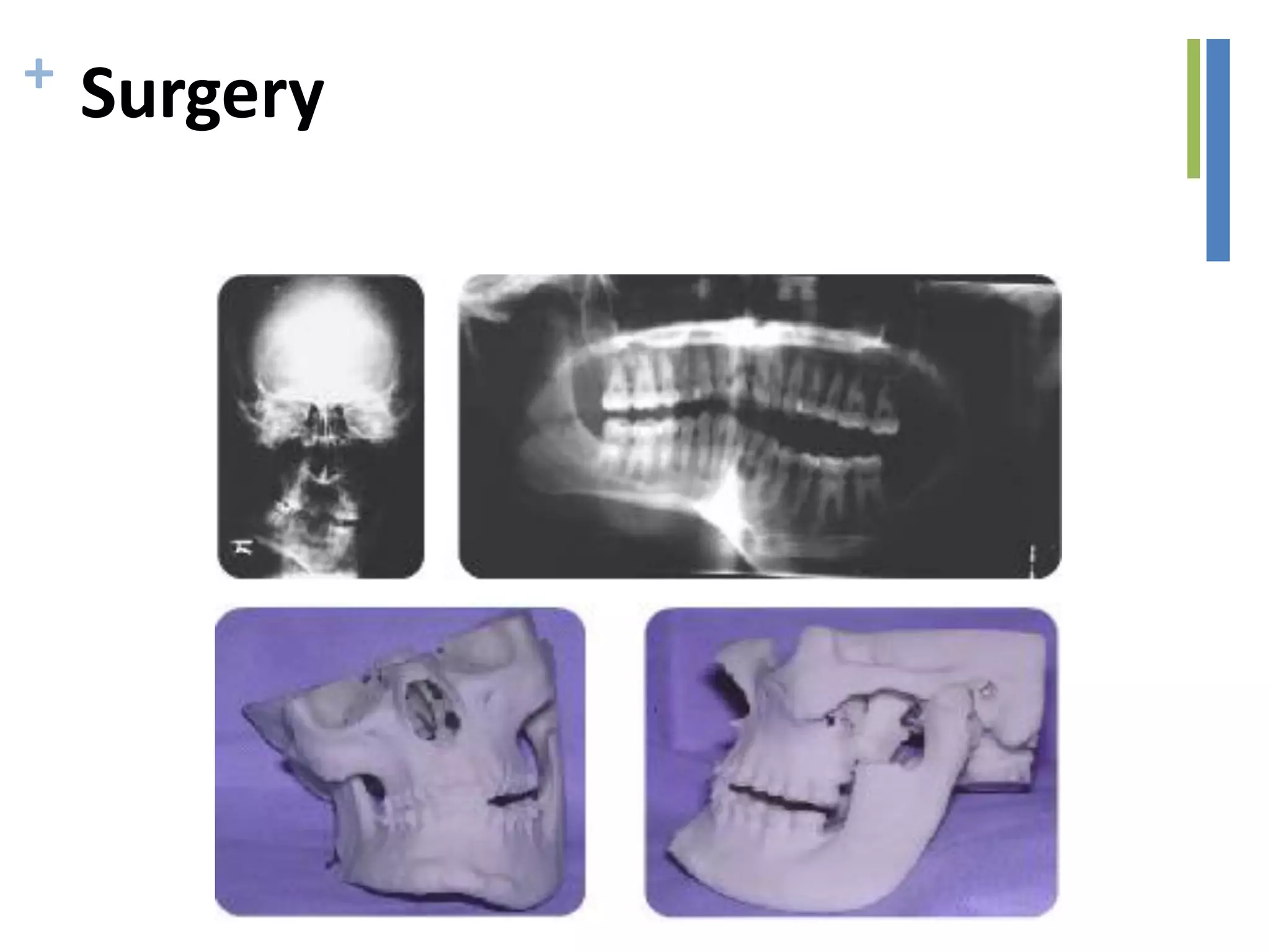 + Surgery
 
