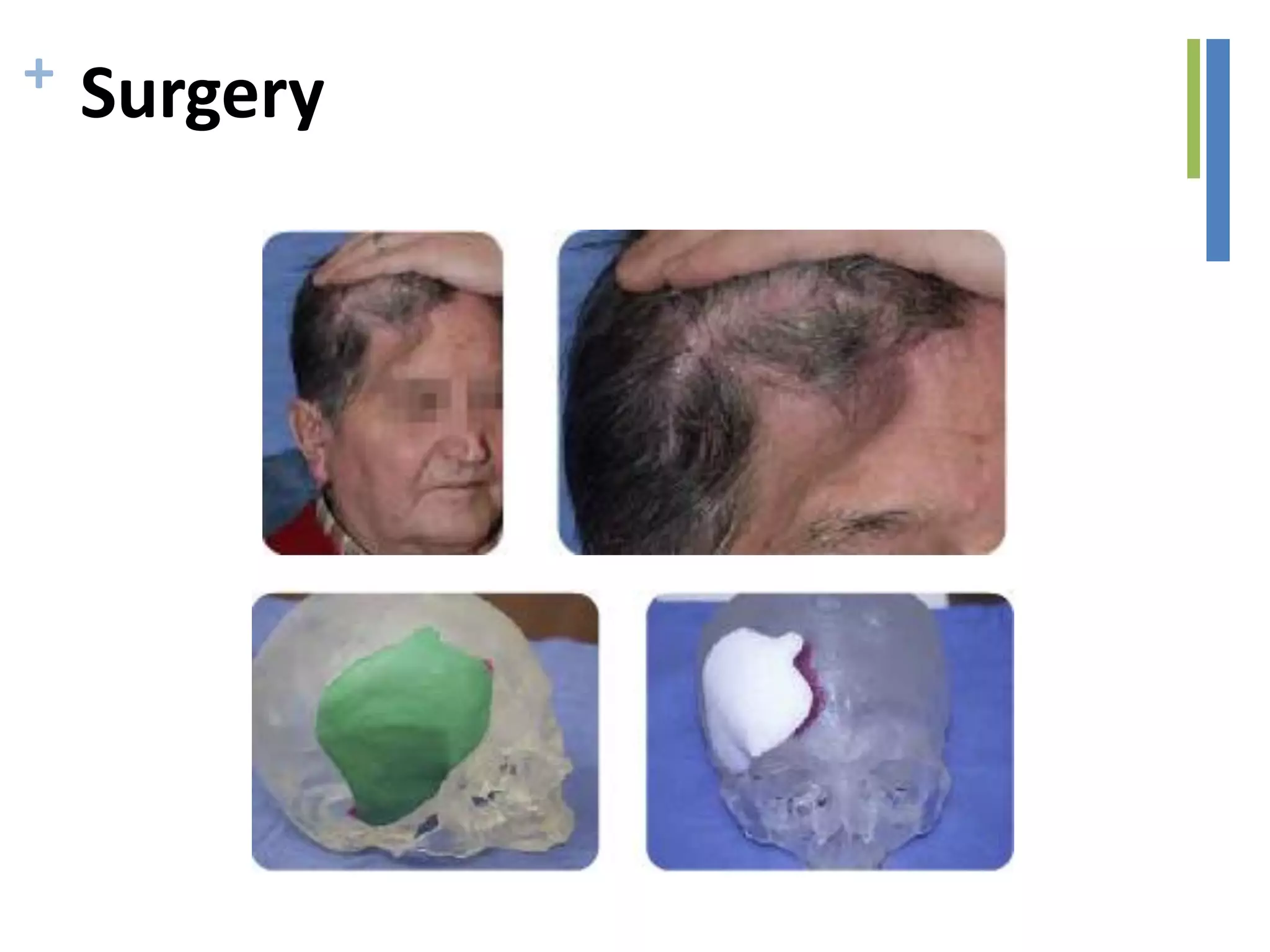 + Surgery
 