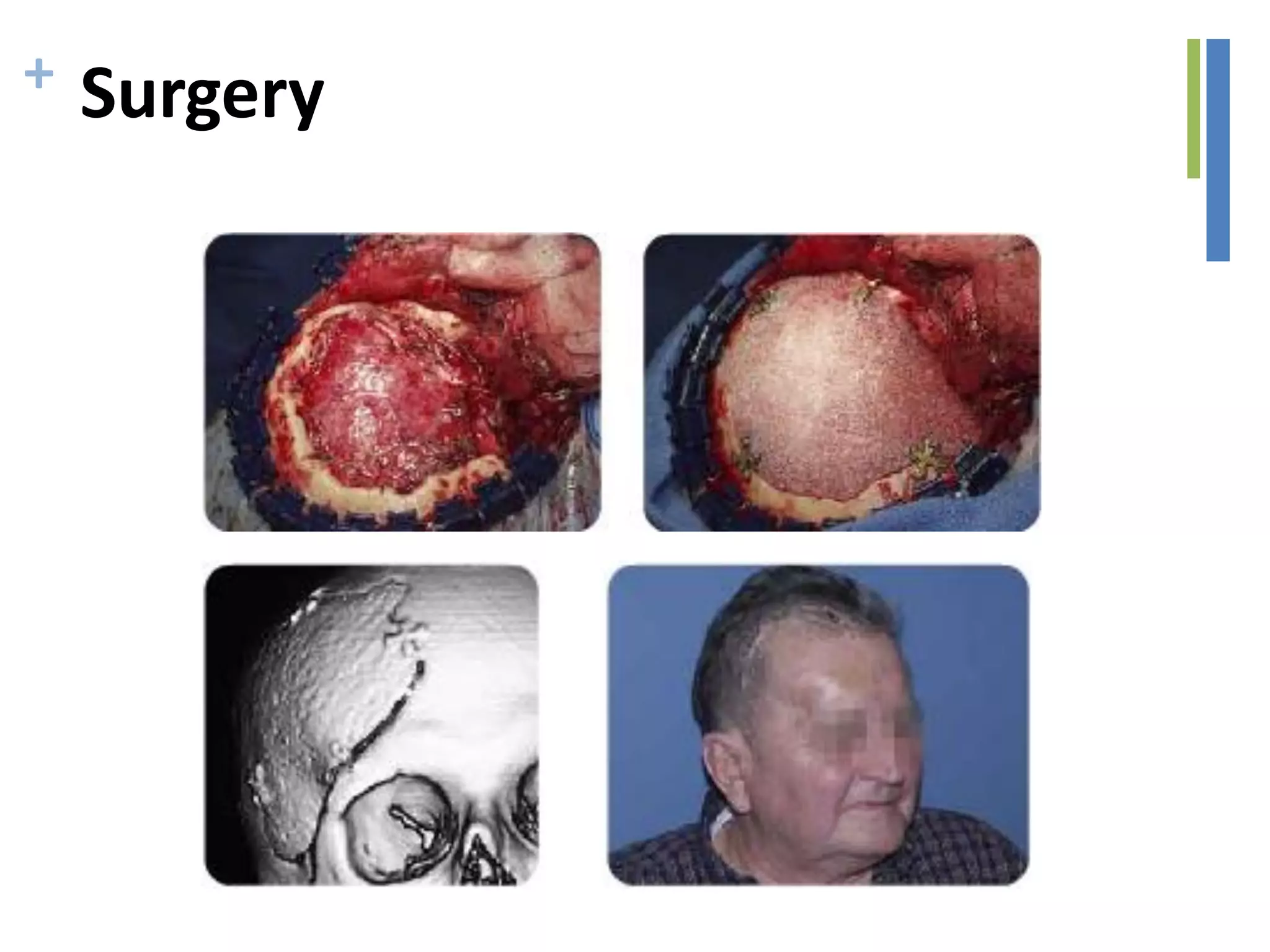 + Surgery
 