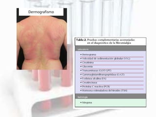 Dermografismo
 