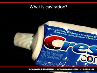 What is cavitation?
 