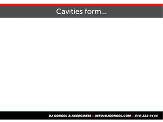 Cavities form...
 