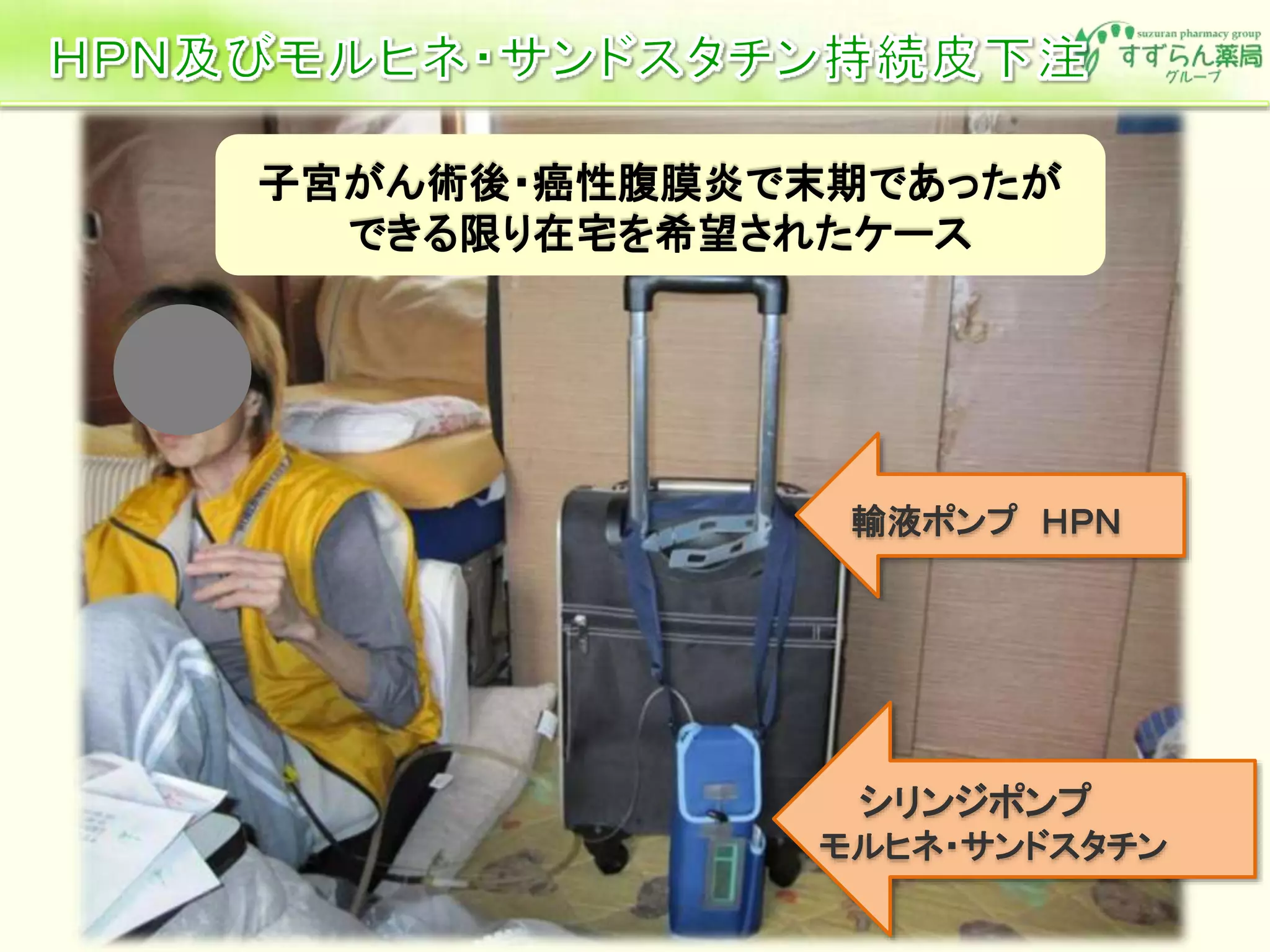 輸液ポンプ ＨＰＮ
シリンジポンプ
モルヒネ・サンドスタチン
子宮がん術後・癌性腹膜炎で末期であったが
できる限り在宅を希望されたケース
 