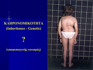 ΚΛΗΡΟΝΟΜΙΚΟΤΗΤΑ
(Inheritance - Genetic)
?
(υποφυσιογενής νανισμός)
 