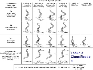 Lenke’s
Classificatio
n
 