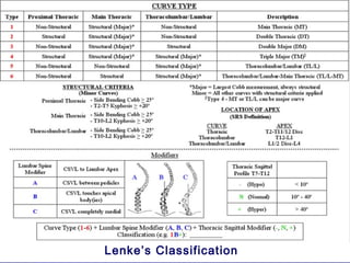 Lenke’s Classification
 