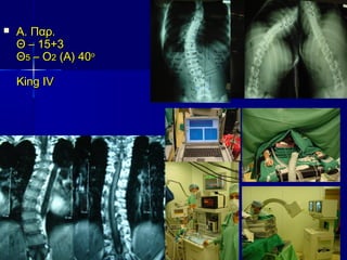  Α. Παρ.Α. Παρ.
ΘΘ –– 15+315+3
ΘΘ55 – Ο– Ο22 (Α) 40(Α) 40οο
King IVKing IV
 