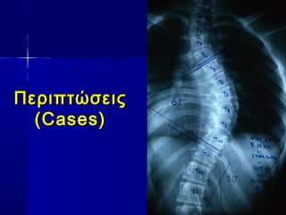 ΠεριπτώσειςΠεριπτώσεις
(Cases)(Cases)
 