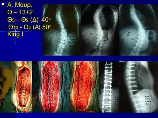  Α. Μαυρ.Α. Μαυρ.
ΘΘ –– 13+213+2
ΘΘ55 – Θ– Θ99 (Δ) 40(Δ) 40οο
ΘΘ1010 - Ο- Ο44 (Α) 50(Α) 50οο
King IKing I
 