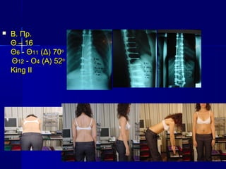  Β. Πρ.Β. Πρ.
ΘΘ –– 1616
ΘΘ66 - Θ- Θ1111 (Δ) 70(Δ) 70οο
ΘΘ1212 - Ο- Ο44 (Α) 52(Α) 52οο
King IIKing II
 