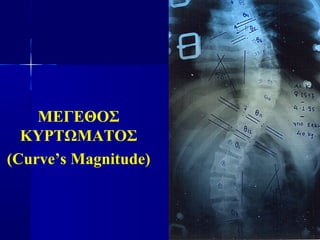 ΜΕΓΕΘΟΣ
ΚΥΡΤΩΜΑΤΟΣ
(Curve’s Magnitude)
 