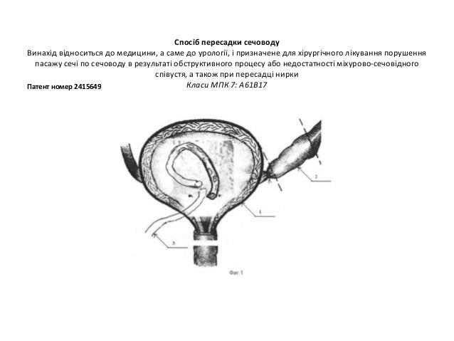 Право Інтелектуальної Власності На Винахід Корисну Модель Промисловий ...