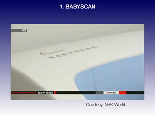 Courtesy, NHK World
1. BABYSCAN
 