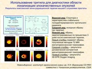Использование тритила для диагностики области
локализации злокачественных опухолей
Результаты комплексной генно-радиационной терапии мышей с опухолями простаты
S
S S
S
HO
HO
OH
OH
OHO
D
D
D
D
D D
D D
S
SS
S OH
OHHO
HO
O OH
D
D
D
D
DD
DD
SS
S S
HOOH
OH HO
O
OH
D
D
D
D
D
D
D
D
C
ГидрофильныйГидрофильный тритилтритил
OX63OX63--dd2424
logP –1.80 (pH=2)
logP – 5.30 (pH=7)
Время жизни радикала:
t½ (кровь) > 11 чч
t½ (водный раствор с давлением
150 торр кислорода) > 11 месяцамесяца
Полуширина линии в ЭПР-спектре:
75 mG = 0.075 G
Верхний ряд: Структура и
характеристики стабильного
полидейтерированного тритильного
радикала
Средний ряд: исходные образы
(до терапии)
Нижний ряд: образы,
зарегистрированные по прошествии 3
дней после комплексной терапии.
Левый столбец содержит образы,
полученные методом T2 MRI
магниторезонансной томографии.
Средний столбец – результаты
динамической контрастной
магниторезонансной томографии.
Правый столбец – результаты
3D EPR Oxygen Imaging
Новосибирский институт органической химии им. Н.Н. Ворожцова СО РАН
совместно с Чикагским университетом, США
 