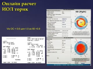 Онлайн расчетОнлайн расчет
ИОЛ торикИОЛ торик
Vis ОС = 0.6 цил-1.0 ах 60 =0.9
 