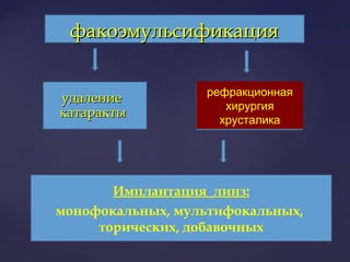 удалениеудаление
катарактыкатаракты
факоэмульсификацияфакоэмульсификация
рефракционная
хирургия
хрусталика
Имплантация линз:
монофокальных, мультифокальных,
торических, добавочных
 