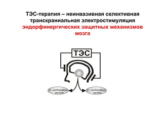 ТЭС-терапия – неинвазивная селективная
транскраниальная электростимуляция
эндорфинергических защитных механизмов
мозга
 