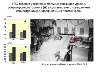 ТЭС-терапия у ожоговых больных повышает уровень
соматотропного гормона (А) в соответствие с повышением
концентрации β-эндорфина (В) в плазме крови
Фото из журнала «Наука и жизнь», 2001, № 1
В
0
0,5
1
1,5
2
2,5
ТЭС
нг/мл
Контр.
0
20
40
60
80
100
120
140
Контр.ТЭС
пг/мл
А
В
 