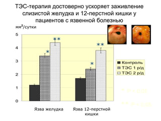 0
1
2
3
4
5
Контроль
ТЭС 1 р/д
ТЭС 2 р/д
Язва желудка Язва 12-перстной
кишки
ТЭС-терапия достоверно ускоряет заживление
слизистой желудка и 12-перстной кишки у
пациентов с язвенной болезнью
**
**
*
*
* Р < 0,05
** Р < 0,05
мм²/сутки
 