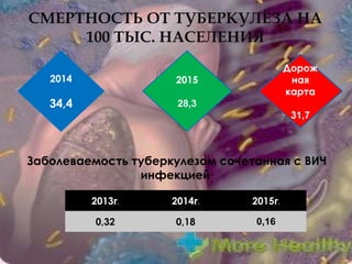 СМЕРТНОСТЬ ОТ ТУБЕРКУЛЁЗА НА
100 ТЫС. НАСЕЛЕНИЯ
16
2014
34,4
2015
28,3
Дорож
ная
карта
31,7
2013г. 2014г. 2015г.
0,32 0,18 0,16
Заболеваемость туберкулезом сочетанная с ВИЧ
инфекцией
 
