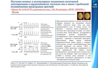 •Проект № 14-04-01781, руководитель акад. Л.В. Розенштраух, ФГБУ «РКНПК» г.
Москва
ЭХО между
генерирующими
собственный ритм под
действием НА
кардиомиоцитами
в дистальной части
легочных вен
и кардиомиоцитами в
устье легочных вен.
ЭХО между
стимулируемым
с периодом 300мс
предсердием
и кардиомиоцитами в
дистальной
части легочных вен
под действием НА.
Дистальная
часть ЛВ
Дистальная
часть ЛВ
Устья ЛВ
Устья ЛВ
ЭХО 2 : 1
При выполнении проекта в системе легочных вен
впервые выявлено так называемое явление
«ЭХО», известное ранее лишь для атрио-
вентрикулярного узла. В нашем случае этот
феномен - отражение волны возбуждения от
легочных вен в предсердия и возврат его снова в
легочные вены. Таким образом, поддерживается
непрерывная ротация возбуждения и
поддерживается самая распространенная форма
аритмий - мерцания и трепетания предсердий.
Вегетативные нервы сердца, например
парасимпатические нервы сердца, с помощью
ацетилхолина создают однонаправленный блок,
который необходим для запуска "ЭХО". С
помощью «ЭХО» происходит непрерывный (А),
либо прерывистый (В) переход волны
возбуждения от дистальной части легочных вен к
их устью или наоборот. При этом показано, что
«ЭХО» в легочных венах возникает за счет
медленной кальциевой проводимости на фоне
деполяризации потенциала покоя.
Egorov Y.V., Kuz’min V.S., Glukhov A.V., Rosenshtraukh L.V. Electrophysiological Characteristics, Rhythm, Disturbances and
Conduction Discontinuities Under Autonomic Stimulation in the Rat Pulmonary Vein Myocardium. J. Cardiovasc. Electrophysiol.
2015 Oct;26(10):1130-9.
 