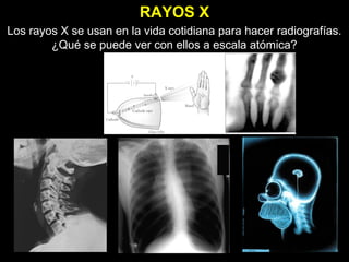 RAYOS X
Los rayos X se usan en la vida cotidiana para hacer radiografías.
¿Qué se puede ver con ellos a escala atómica?
 