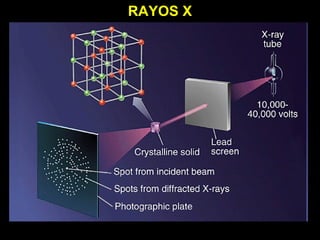 RAYOS X
 
