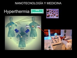 Hyperthermia SPM
nanoparticles
NANOTECNOLOGÍA Y MEDICINA
 