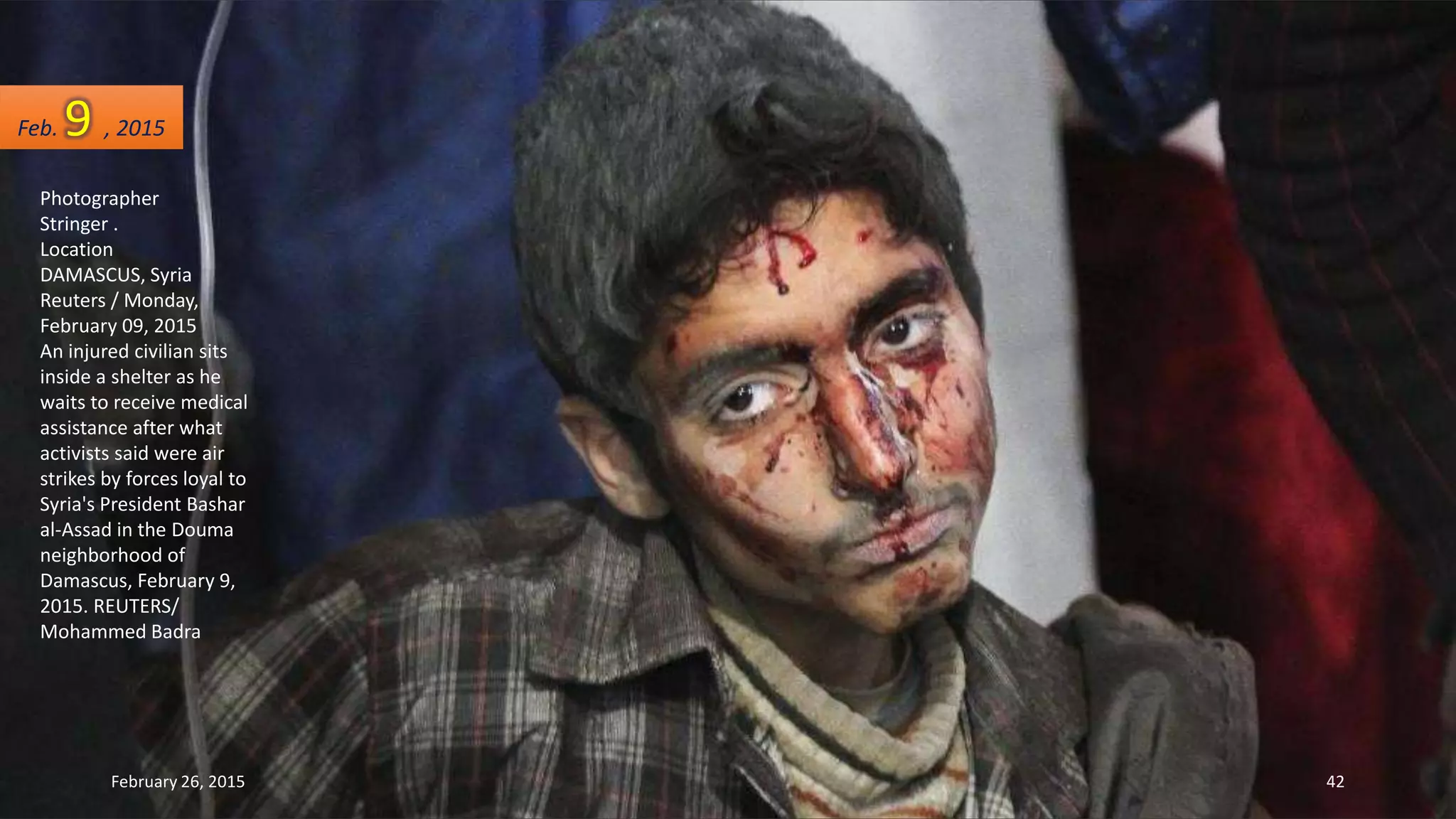 Photographer
Stringer .
Location
DAMASCUS, Syria
Reuters / Monday,
February 09, 2015
An injured civilian sits
inside a shelter as he
waits to receive medical
assistance after what
activists said were air
strikes by forces loyal to
Syria's President Bashar
al-Assad in the Douma
neighborhood of
Damascus, February 9,
2015. REUTERS/
Mohammed Badra
Feb. 9 , 2015
February 26, 2015 42
 