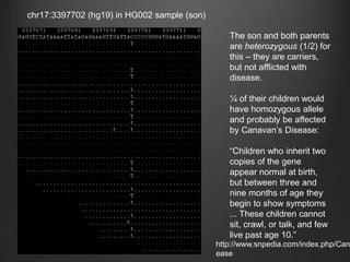 chr17:3397702 (hg19) in HG002 sample (son)
The son and both parents
are heterozygous (1/2) for
this – they are carriers,
but not afflicted with
disease.
¼ of their children would
have homozygous allele
and probably be affected
by Canavan’s Disease:
“Children who inherit two
copies of the gene
appear normal at birth,
but between three and
nine months of age they
begin to show symptoms
... These children cannot
sit, crawl, or talk, and few
live past age 10.”
http://www.snpedia.com/index.php/Can
ease
 