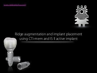 Ridge augmentation and implant placement
using CTi-mem and IS ll active implant
www.neobiotechus.com
 