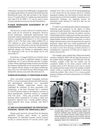 Review Article
203 Apollo Medicine, Vol. 8, No. 3, September 2011
TIMI grade 3 (normal) from TIMI grade 2 (sluggish) flow
by comparing the density of contrast at the distal end of the
thrombolysed artery with that proximal to the stenotic
lesion. CT number distal /CT number proximal should be
more than 0.54 for TIMI 3. CT can be used to assess
coronary reperfusion noninvasively after thrombolysis.
PLAQUE REGRESSION ASSESSMENT BY CT
ANGIOGRAPHY
The discovery of early CAD on CT would be futile if
these could not be resolved by medication. However
several multicenter, randomized lipid-lowering trials
using both catheter angiographic and clinical assessment
showed a negligible improvement ((1 to 3%) of luminal
caliber on ICA. Yet these same studies yielded 25% to
75% reduction in acute events, including myocardial
infarction [12-14]. This points to the fact that the benefits
of lipid-lowering therapy are derived by stabilization of
lipid-rich plaques, not changes in angiographic lumen
size. Regression in the size of the plaque can be well
assessed by CT.
Kaori Inoue, et al suggest that the use of statins even at
a low dose may result in significant changes in plaque
morphology on CT and an absolute decrease in plaque
volume without significant change in lumen size and when
the changes in lipid profile are not statistically significant.
This suggests that the changes in the plaque morphology
may even occur with relatively less robust changes in the
lipid profile, and may occur early after statin use [15].
STRESS MYOCARDIAL CT PERFUSION IS HERE
Stress myocardial computed tomography perfusion
(CTP) is a novel examination that provides both anatomic
and physiological information (i.e., myocardial
perfusion). Multiple single-center studies have
established the feasibility of stress myocardial CTP.
Furthermore, it has been illustrated that a combined
CCTA/CTP protocol improves the diagnostic accuracy to
detect hemodynamic significant stenosis as compared
with CTA alone. Stress and reversible myocardial
perfusion deficit measured by CT using a visual semi
quantitative approach and a visually guided software-
based approach show strong similarity with SPECT
[16,17].
CT AND ICA DISAGREEMENT ON PERCENTAGE
STENOSIS. “NEVER THE TWAIN SHALL MEET”
Despite good sensitivity and specificity for detecting
significant coronary artery disease in patients,
disagreement on individual coronary arterial stenosis
severity is common between CT and the current “gold
standard” ICA. This is true for IVUS and histopathology
as well, which also do not correlate with ICA. Catheter
angiogram readings vary from doctor to doctor and such
inconsistencies as well as the modality’s limitations as a 2-
dimensional technique are important reasons for
discrepant results between CT and ICA that are less
acknowledged.
CT and ICA are fundamentally different technologies.
Expecting good agreement on the degree of lumen
narrowing is rather unrealistic. Importantly, percentage of
stenosis is of uncertain relevance for patient outcome.
Arbab-Zadeh and Hoe clearly point out that assessment of
total (calcified and non-calcified) coronary atherosclerotic
plaque burden, number of lesions and location, as well as
plaque characterization, show strong promise for superior
prognostic impact than mere lesion quantification and
thus, deserve more of our attention. In the upcoming years,
we need to evolve from focusing on lumen stenosis to a
comprehensive assessment of CAD and its impact on
patient outcome [18].
For example a glass cylinder that is filled with marbles
and then completely filled with ink hides the presence of
the marbles within and appears to be filled only with ink.
Similarly, complex CAD like the marbles can be
completely hidden by the dense contrast within the
coronary artery on ICA. However if one were to section
the cylinder and look within with CT the marbles would be
clearly visible as would the real amount of narrowing
within the cylinder. This is how CT is a more accurate
measure of degree of stenosis and presence of CAD than
ICA (Fig.3).
Fig.3 (a) Coronary CT reveals a very short intraluminal
complex filling defect in this symptomatic patient. (b)
However Catheter angio reveals a subtle irregularity
only on very careful scrutiny. (c&d) explain how an
intraluminal plaque causing an non concentric stenosis
can be missed on the 2 D projections of the catheter
anglogram (taken from reference 2).
 