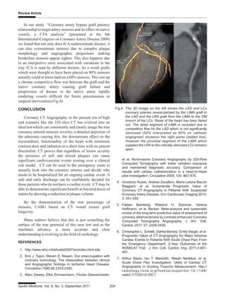 Review Article
Apollo Medicine, Vol. 8, No. 3, September 2011 204
In our study “Coronary artery bypass graft patency
relationship to target artery stenosis and its effect on native
vessels, a CTA analysis” (presented at the 8th
International Congress on Coronary Artery Disease 2009)
we found that not only does ICA underestimate disease, it
can also overestimate stenosis due to complex plaque
morphology and angiographic projections making
borderline stenosis appear tighter. This also happens due
to an interpretive error associated with variations in the
way ICA is read by different doctors. As a result grafts
which were thought to have been placed on 80% stenosis
actually could at times land on a 60% stenosis. This sets up
a chronic competitive flow war between the graft and the
native coronary artery causing graft failure and
progression of disease in the native artery rapidly
rendering vessels difficult for future percutaneous or
surgical intervention (Fig.4).
CONCLUSION
Coronary CT Angiography in the present era of high
end scanners like the 320 slice CT has evolved into an
ideal test which can consistently and clearly image the true
coronary arterial stenosis severity, a detailed depiction of
the atheroma causing this, the downstream effect on the
myocardium, functionality of the heart with minimum
contrast dose and radiation in a short time with no patient
discomfort. CT proves that regardless of lesion severity
the presence of soft and mixed plaques can cause
significant cardiovascular events scoring over a clinical
risk model. CT can be used in the emergency room to
actually look into the coronary arteries and decide who
needs to be hospitalized for an ongoing cardiac event. A
safe and early discharge can be confidently decided for
those patients who do not have a cardiac event. CT may be
able to demonstrate significant benefit at lowered doses of
statins by showing a reduction in plaque volume.
By the demonstration of the true percentage of
stenosis, CABG based on CT would ensure graft
longevity.
Many authors believe that this is just scratching the
surface of the true potential of this new test and as the
machines advance, a more accurate and clear
understanding is evolving in the field of cardiology.
REFERENCES
1. http://www.who.int/whostat2007/en/index.html site.
2. Eric J. Topol, Steven E. Nissen. Our preoccupation with
coronary luminology. The dissociation between clinical
and Angiographic findings in Ischemic Heart Disease.
Circulation.1995;92:2333-2342.
3. Marc Dewey, Elke Zimmermann, Florian Deissenrieder,
et al. Noninvasive Coronary Angiography by 320-Row
Computed Tomography with lower radiation exposure
and maintained diagnostic accuracy: Comparison of
results with cardiac catheterization in a head-to-Head
pilot investigation. Circulation 2009, 120: 867-875.
4. Vincenzo Russo, Andrea Zavalloni, Maria Letizia Bacchi
Reggiani, et al. Incremental Prognostic Value of
Coronary CT Angiography in Patients With Suspected
Coronary Artery Disease. Circ Cardiovasc Imaging 2010;
3: 351-359.
5. Fabian Bamberg, Wieland H. Sommer, Verena
Hoffmann, et al. Becker. Meta-analysis and systematic
review of the long term predictive value of assessment of
coronary atherosclerosis by contrast enhanced Coronary
Computed Tomography Angiography. J. Am. Coll.
Cardiol. 2011: 57; 2426-2436.
6. Christopher L. Schlett, Dahlia Banerji, Emily Siegel, et al.
Prognostic Value of CT Angiography for Major Adverse
Cardiac Events in Patients With Acute Chest Pain From
the Emergency Department: 2-Year Outcomes of the
ROMICAT Trial. J. Am. Coll. Cardiol. Img. 2011;4;481-
491.
7. Arthur Nasis, Ian T. Meredith, Nitesh Nerlekar, et al.
Acute Chest Pain Investigation: Utility of Cardiac CT
Angiography in Guiding Troponin Measurement. http://
radiology.rsna.org/lookup/suppl/doi:10.1148/
radiol.11110013/-/DC1
Fig.4 The 3D image on the left shows the LAD and LCx
coronary arteries revascularised by the LIMA graft to
the LAD and the LRA graft from the LIMA to the OM
branch of the LCs. Reast of the heart has been faded
out. The distal segment of LIMA is occluded due to
competitive flow fro the LAD which is not significantly
stenosed (50% interpreted as 80% on catheter
angiogram) shownon the right panel (dotted line).
However the proximal segment of the LIMA which
supplies the LRA to the critically stenosed LCx remains
open.
 