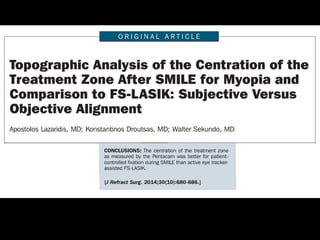 Relex Smile laser surgery | PPT