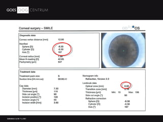 Relex Smile laser surgery | PPT