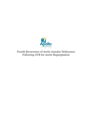 Fourth Recurrence of Aortic Annular Dehiscence
Following AVR for Aortic Regurgitation
 