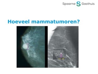 Hoeveel mammatumoren?
 
