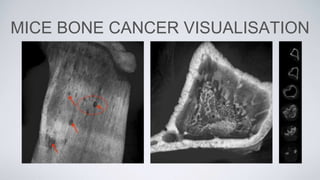 MICE BONE CANCER VISUALISATION
 