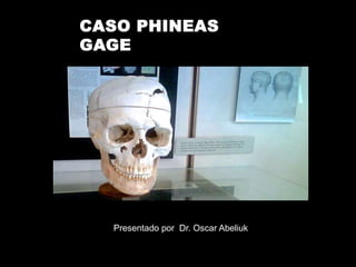 Presentado por Dr. Oscar Abeliuk
CASO PHINEAS
GAGE
 