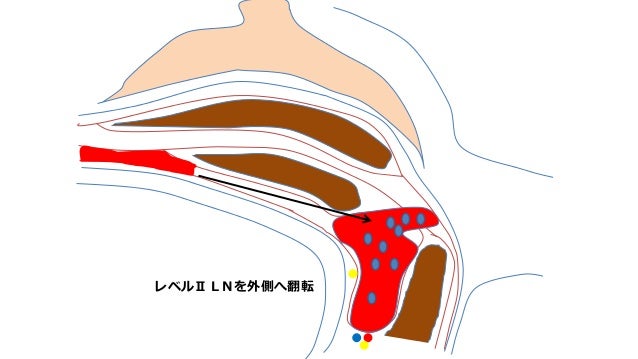 1508大阪 1508大阪