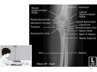 Emergency Radiology: Shoulder & Upper Extremities | PDF