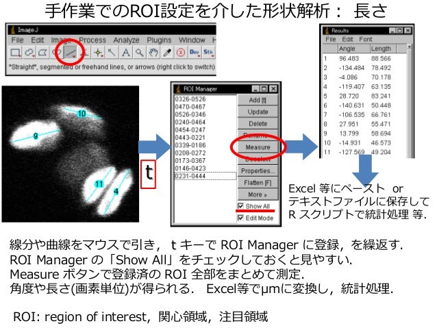 Imagejを使った画像解析実習 2値化 領域抽出