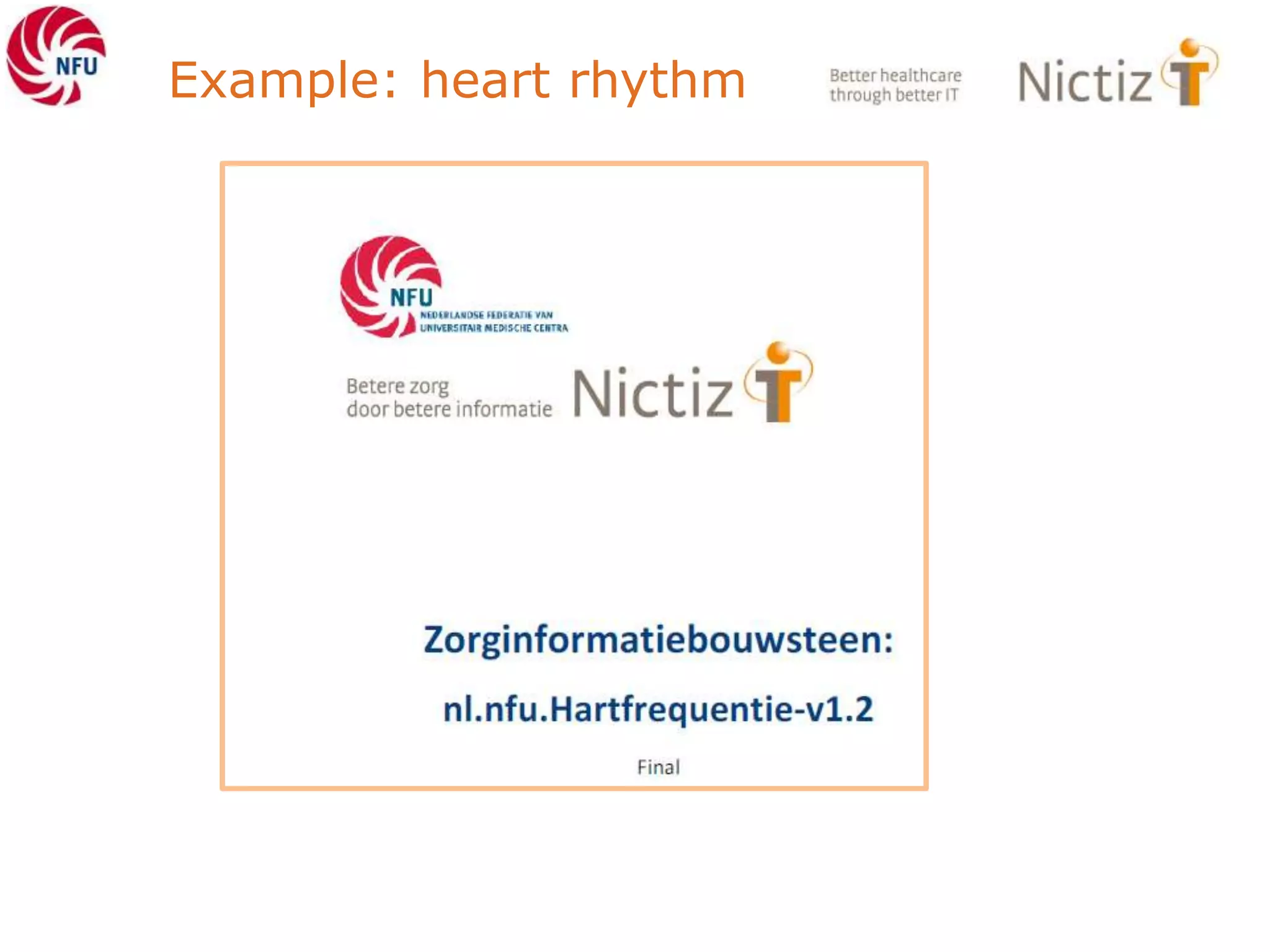 Example: heart rhythm
 