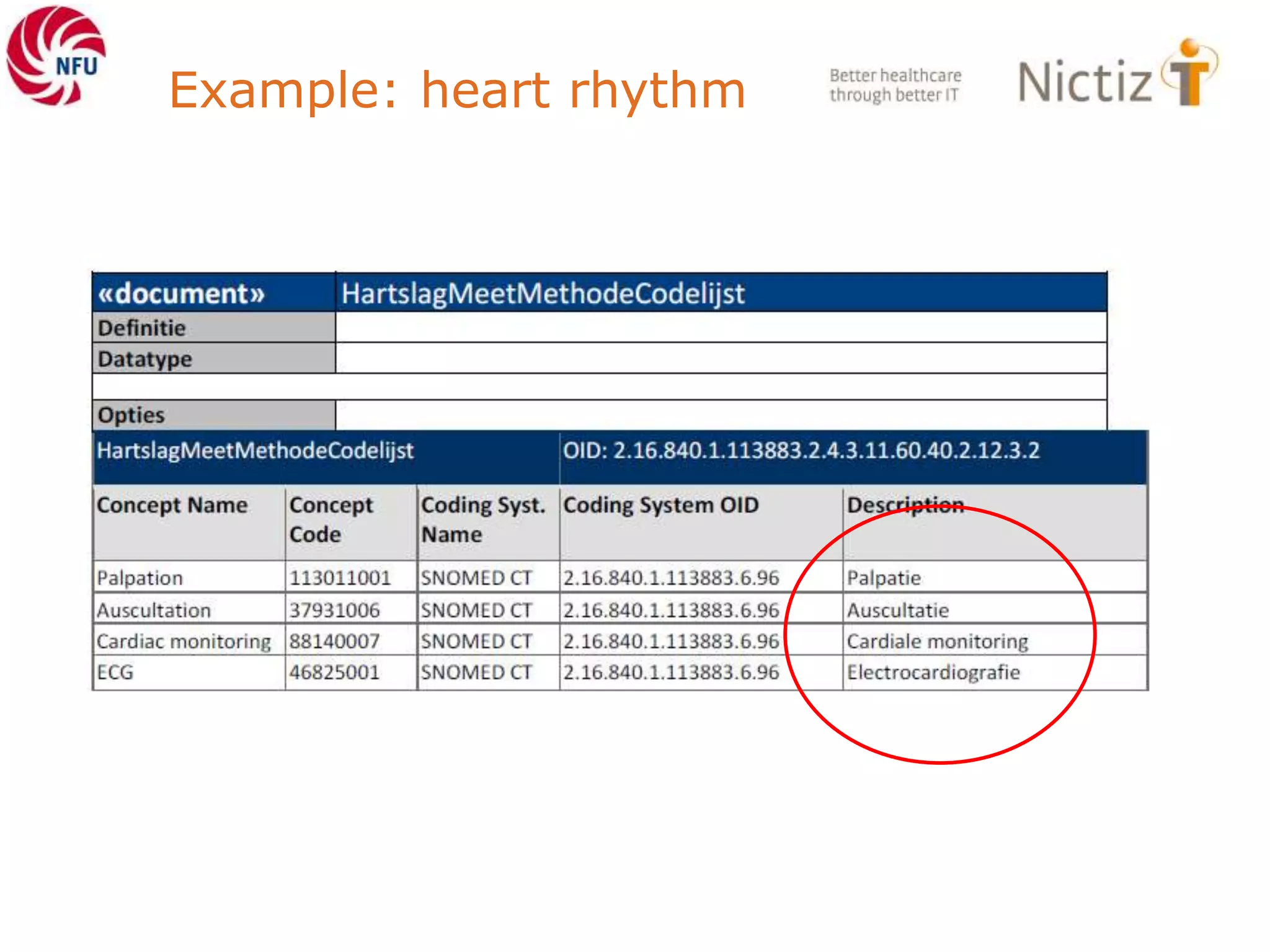 Example: heart rhythm
 