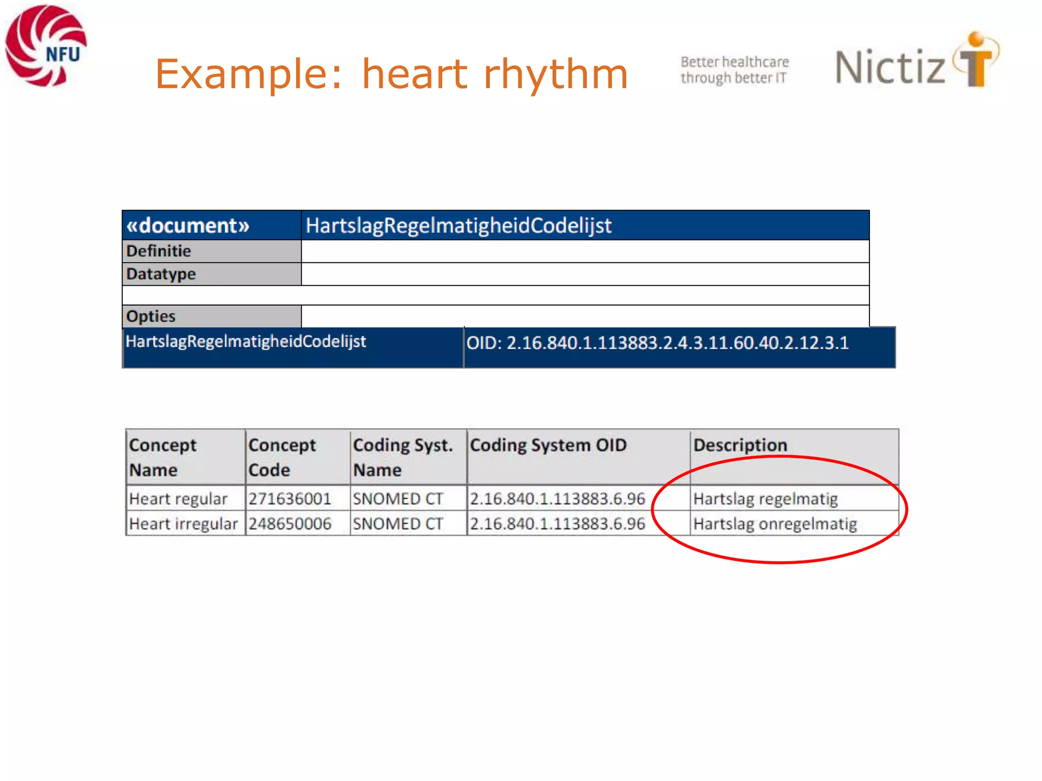 Example: heart rhythm
 